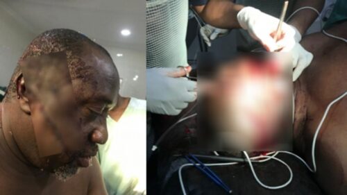 Dana Pilot Attacked N Brutalise By Hoodlums While Jogging