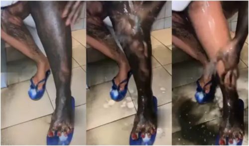 Video Of New Procedures Ladies Use To Bleach Their Skin Trends Online